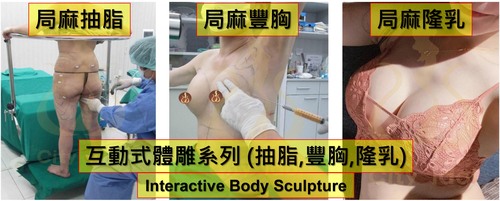 <<< 互動式體雕系列 >>> 三大局部麻醉手術產品圖