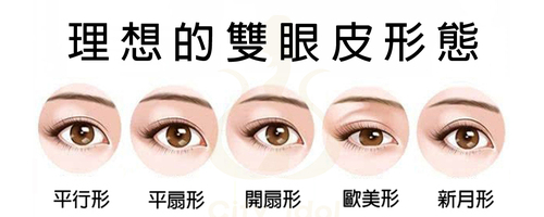 1.單純割雙眼皮 