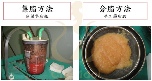 <<< 異常個案之探討 >>> 