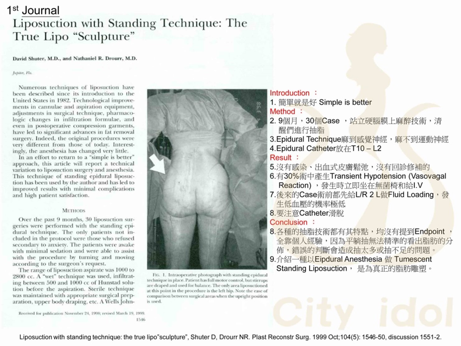 站立抽脂手術何時最早被發表?